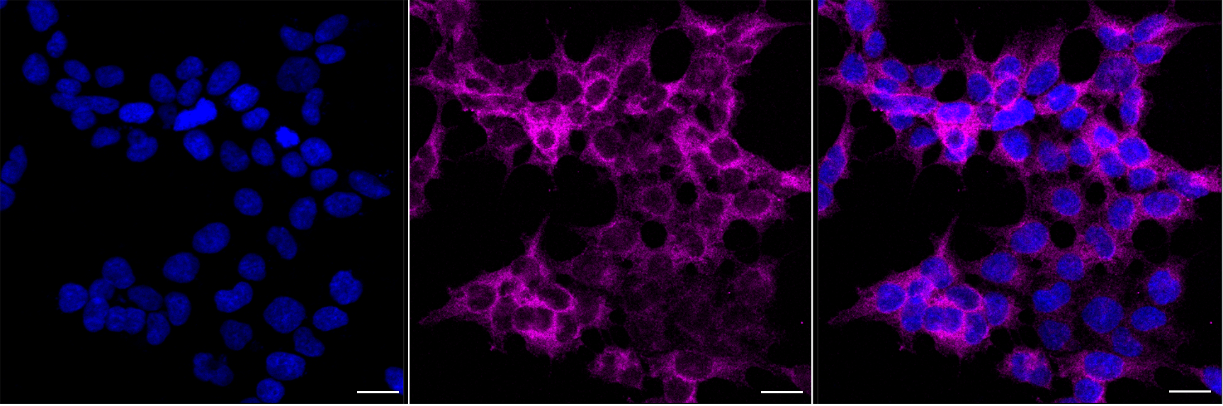 [KO Validated] Anti-ROCK1 Rabbit mAb [91L12S74]