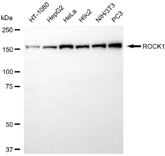 [KO Validated] Anti-ROCK1 Rabbit mAb [91L12S74]