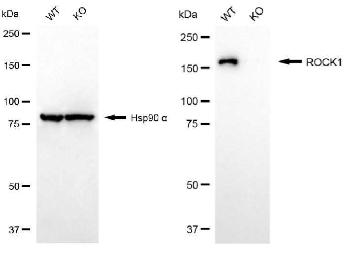 [KO Validated] Anti-ROCK1 Rabbit mAb [91L12S74]