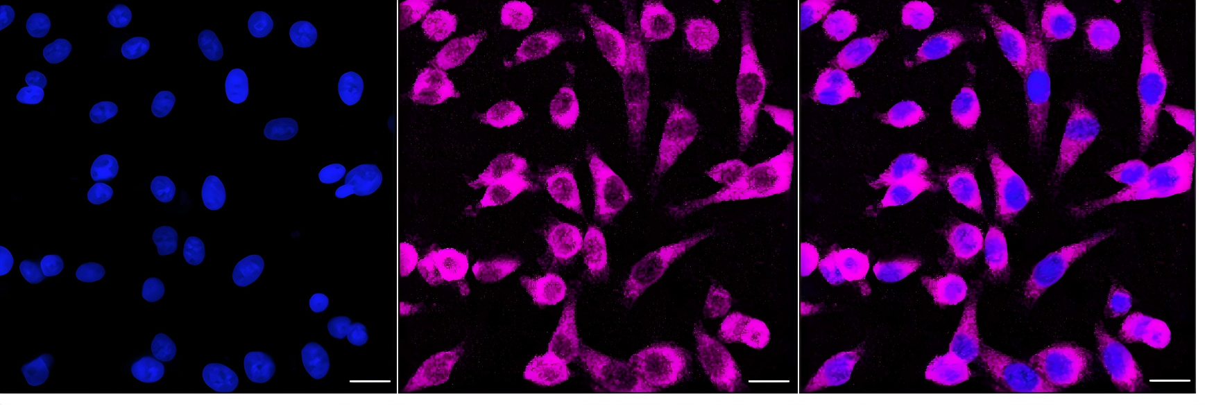 [KO Validated] Anti-EIF2AK2 Rabbit mAb [54R58D61]