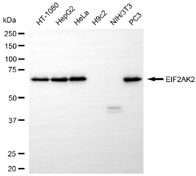[KO Validated] Anti-EIF2AK2 Rabbit mAb [54R58D61]