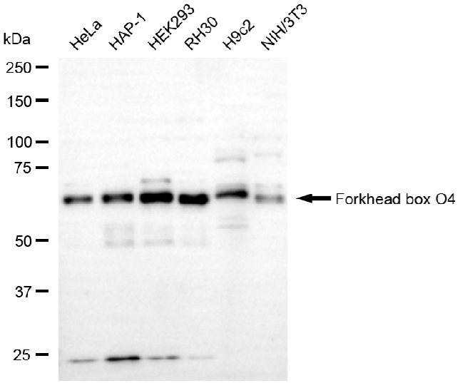 [KO Validated] Anti-FOXO4 Rabbit mAb [72H93T87]