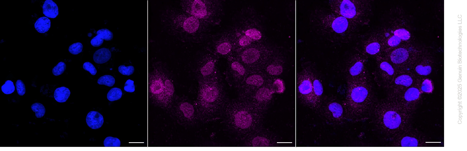[KO Validated] Anti-FYN Rabbit mAb [87A04H74]