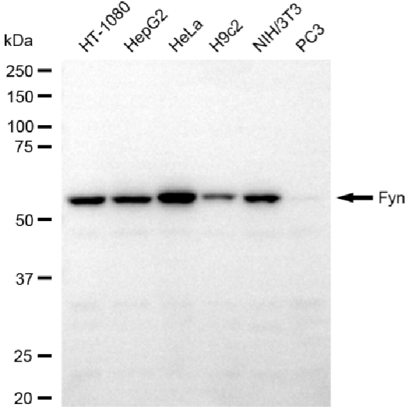[KO Validated] Anti-FYN Rabbit mAb [87A04H74]