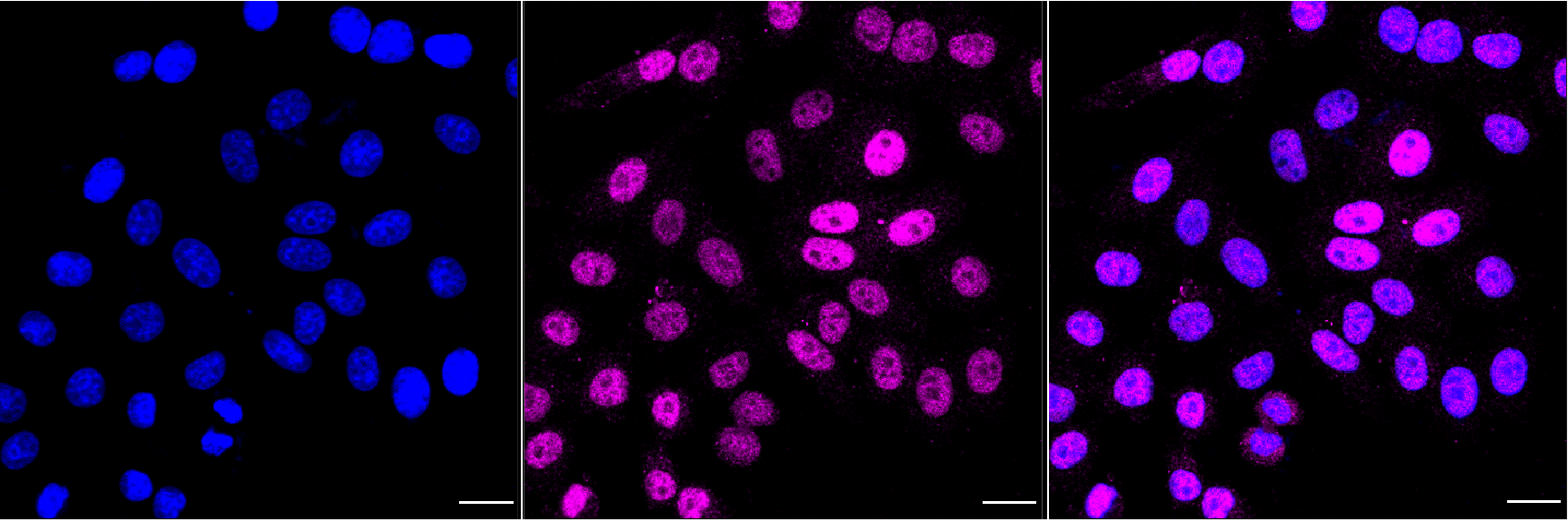 [KO Validated] Anti-ELK1 Rabbit mAb [47C19R13]