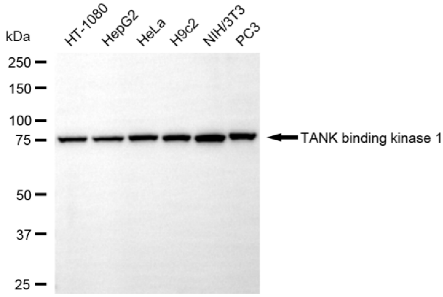 [KO Validated] Anti-TBK1 Rabbit mAb [69Q66S58]