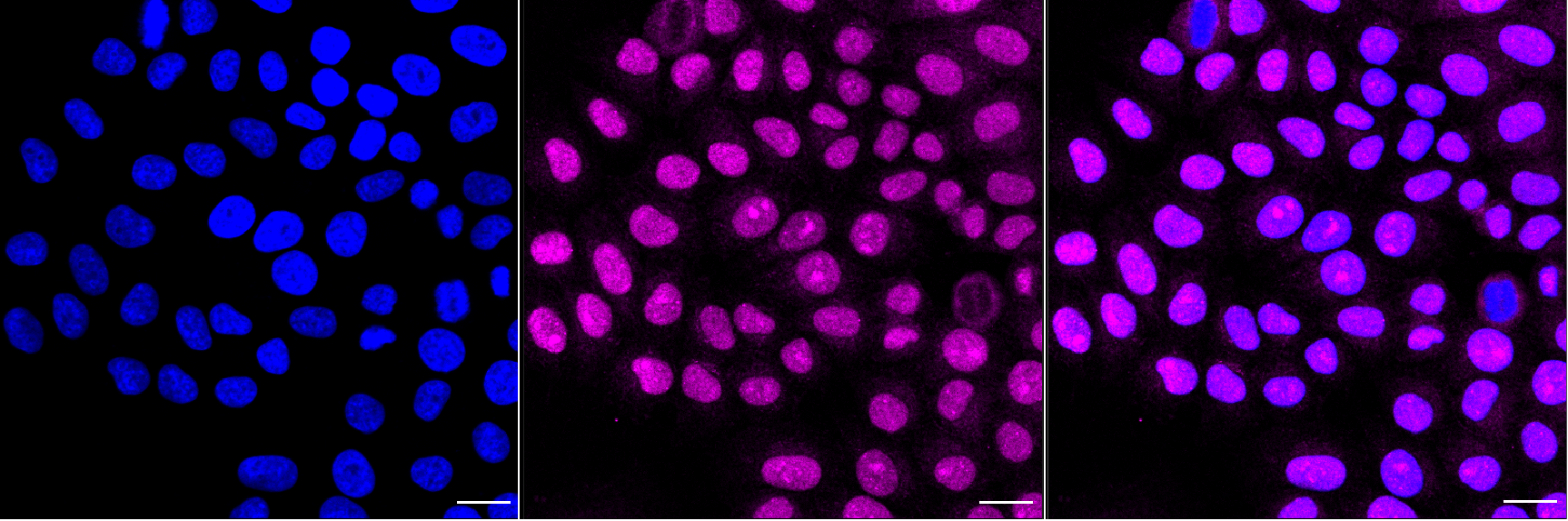 [KO Validated] Anti-CDKN2A Rabbit mAb [91A16M62]