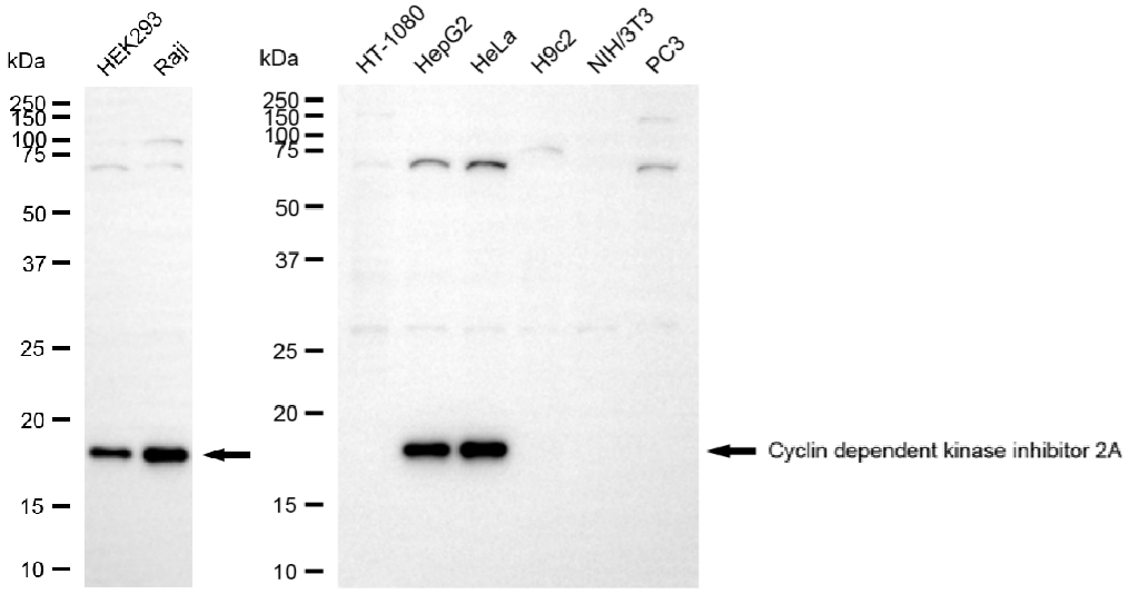 [KO Validated] Anti-CDKN2A Rabbit mAb [91A16M62]