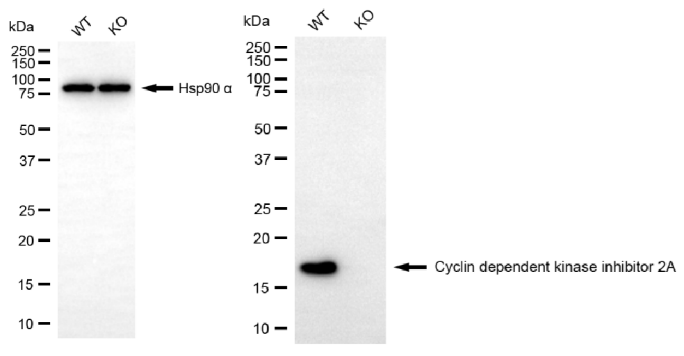 [KO Validated] Anti-CDKN2A Rabbit mAb [91A16M62]