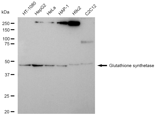[KD Validated] Anti-GSS Rabbit mAb [70S22H89]