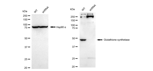 [KD Validated] Anti-GSS Rabbit mAb [70S22H89]
