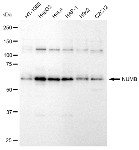 [KD Validated] Anti-NUMB Rabbit mAb [61H40L78]