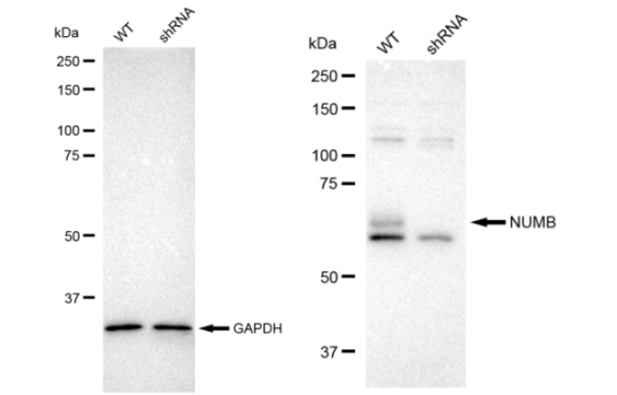 [KD Validated] Anti-NUMB Rabbit mAb [61H40L78]