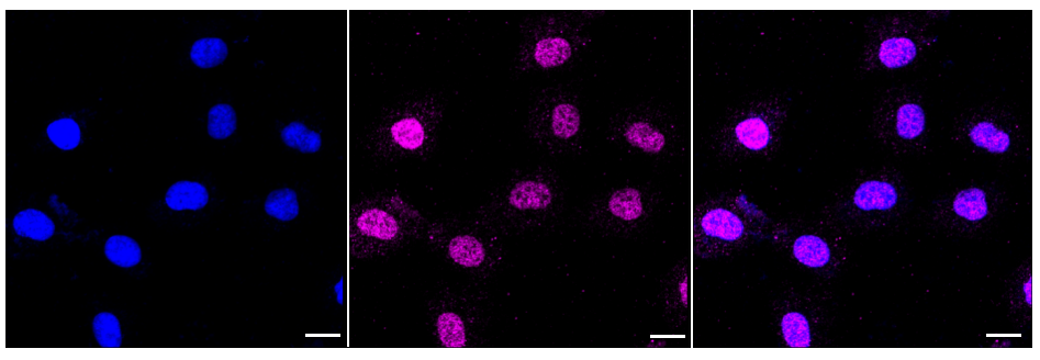 [KD Validated] Anti-STAT6 Rabbit mAb [48E40Q12]