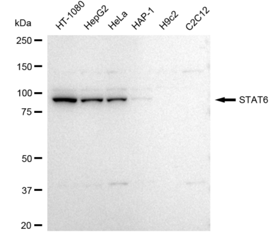 [KD Validated] Anti-STAT6 Rabbit mAb [48E40Q12]