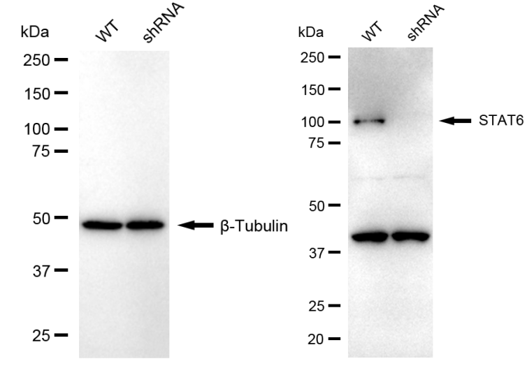 [KD Validated] Anti-STAT6 Rabbit mAb [48E40Q12]