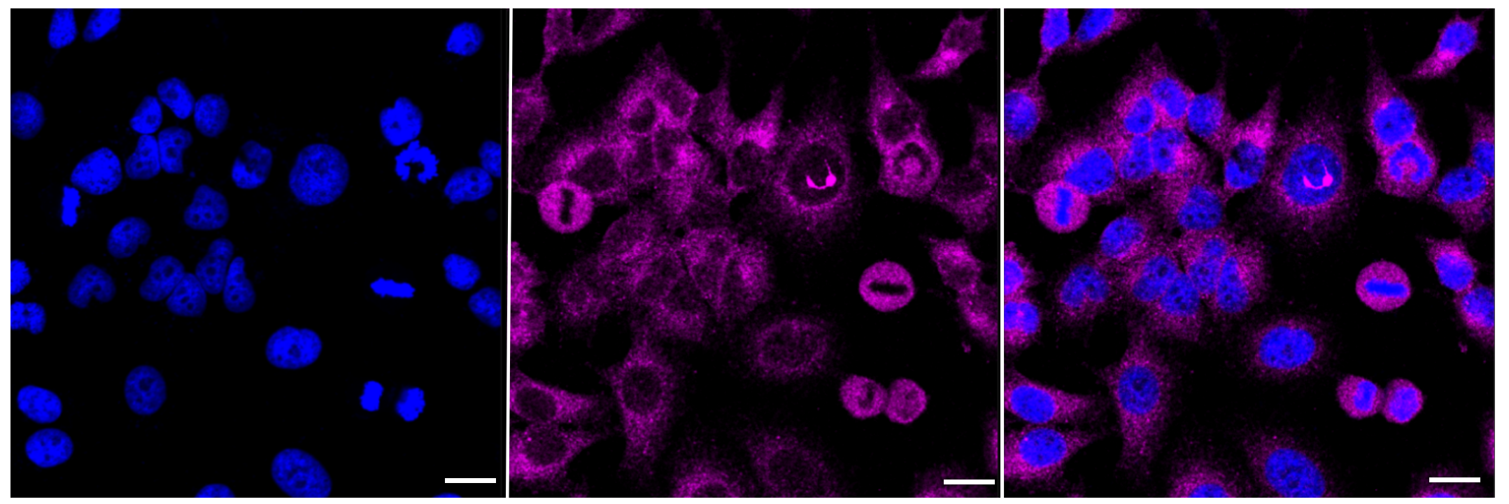 [KD Validated] Anti-TSC2 Rabbit mAb [85T90T43]