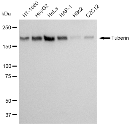 [KD Validated] Anti-TSC2 Rabbit mAb [85T90T43]