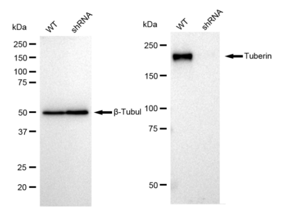 [KD Validated] Anti-TSC2 Rabbit mAb [85T90T43]