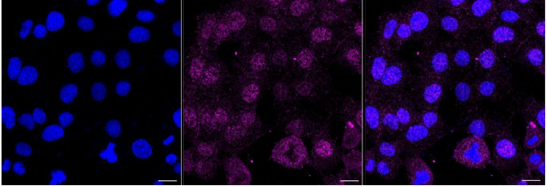 [KD Validated] Anti-CASP3 Rabbit mAb [77N43E45]