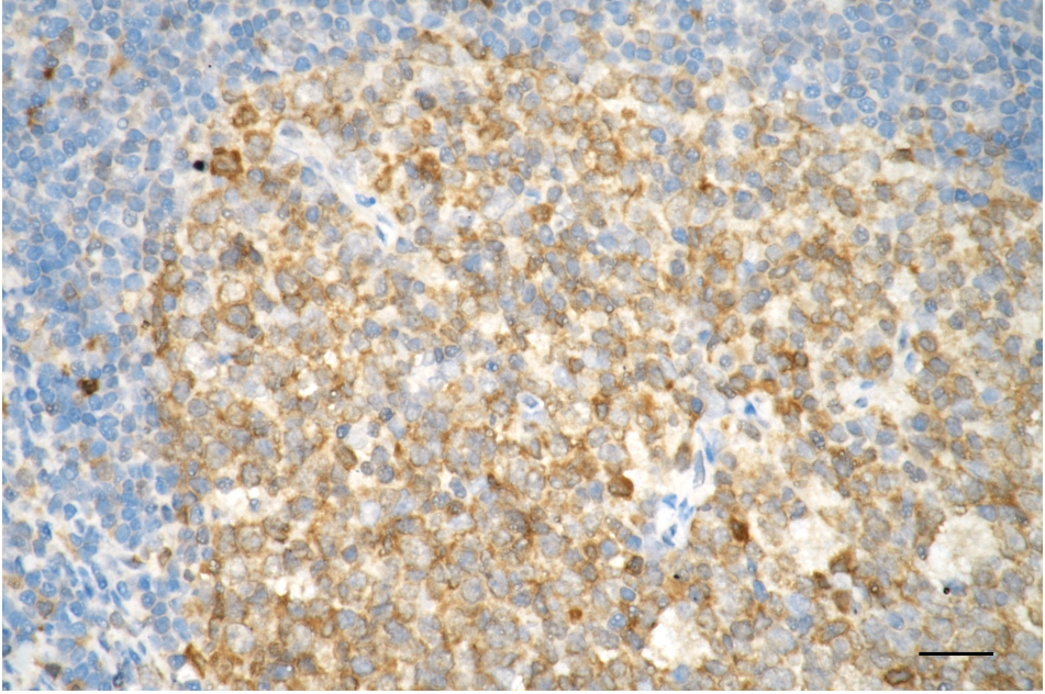 [KD Validated] Anti-CASP3 Rabbit mAb [77N43E45]