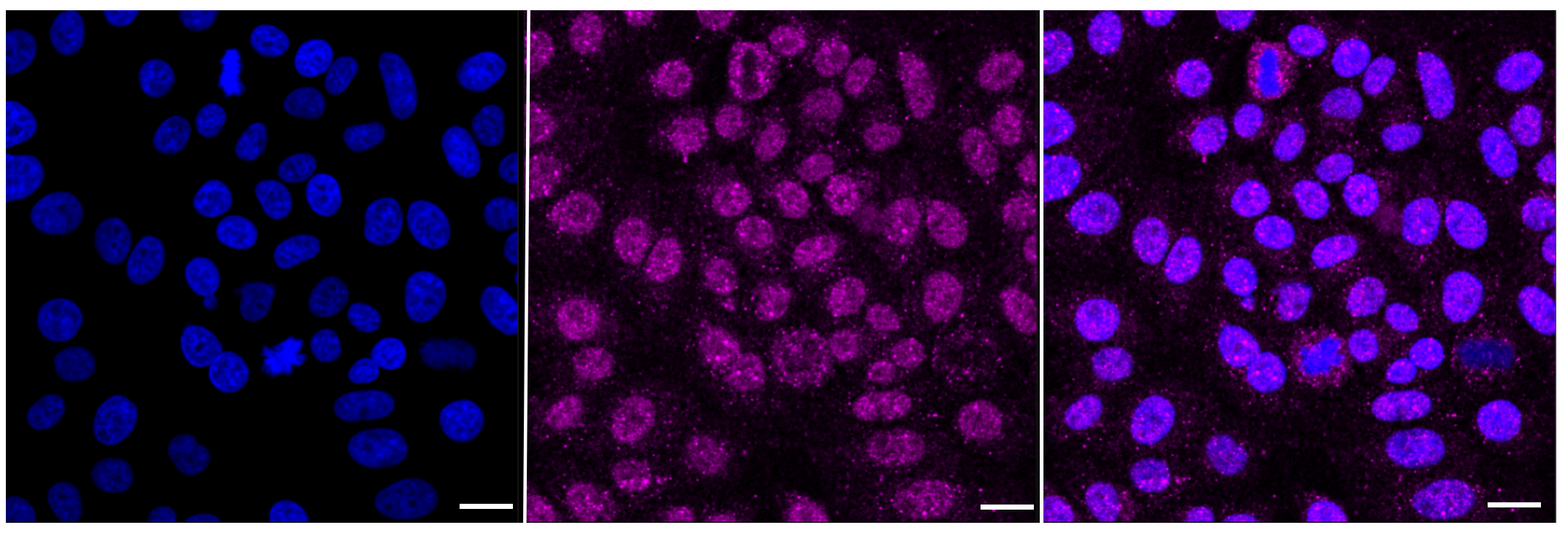 [KD Validated] Anti-ARRB1 Rabbit mAb [67J05S67]