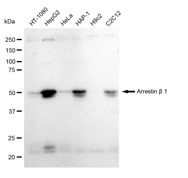 [KD Validated] Anti-ARRB1 Rabbit mAb [67J05S67]