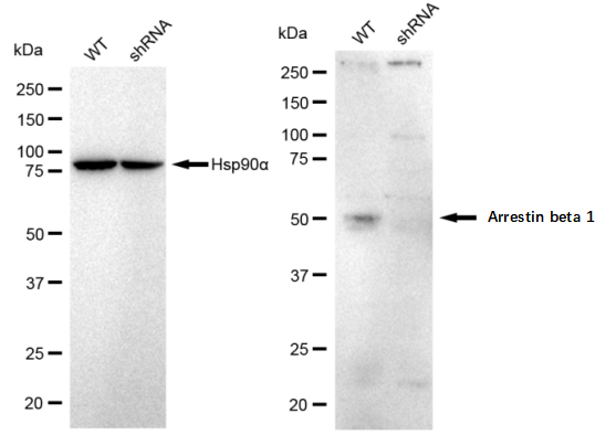 [KD Validated] Anti-ARRB1 Rabbit mAb [67J05S67]