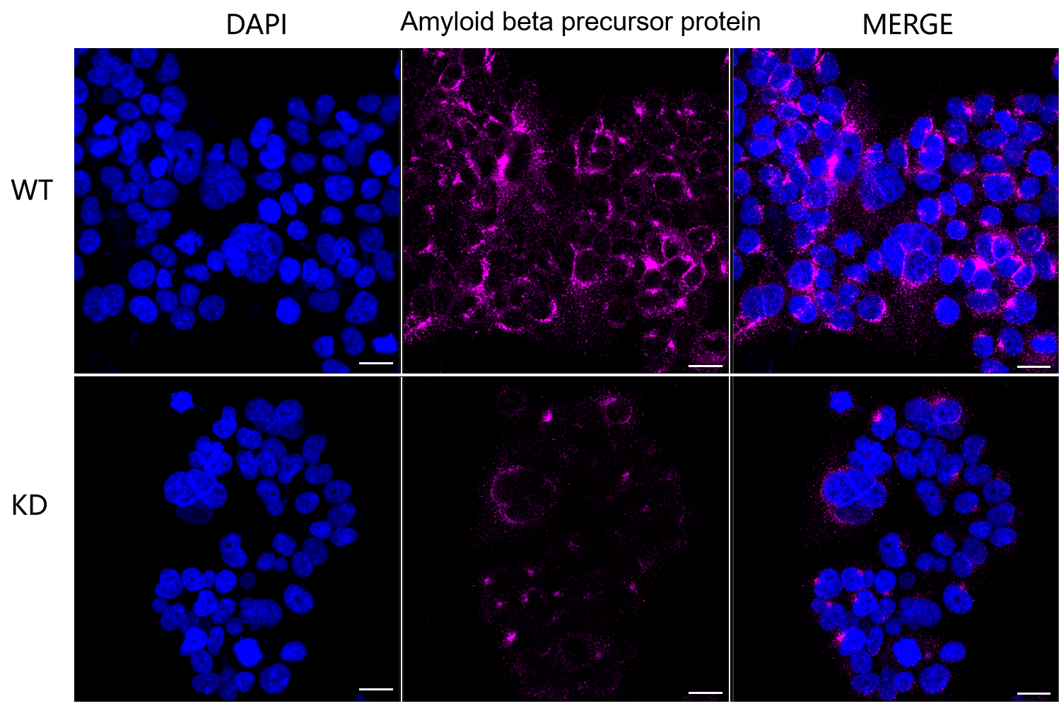[KD Validated] Anti-APP Rabbit mAb [76L88M26]