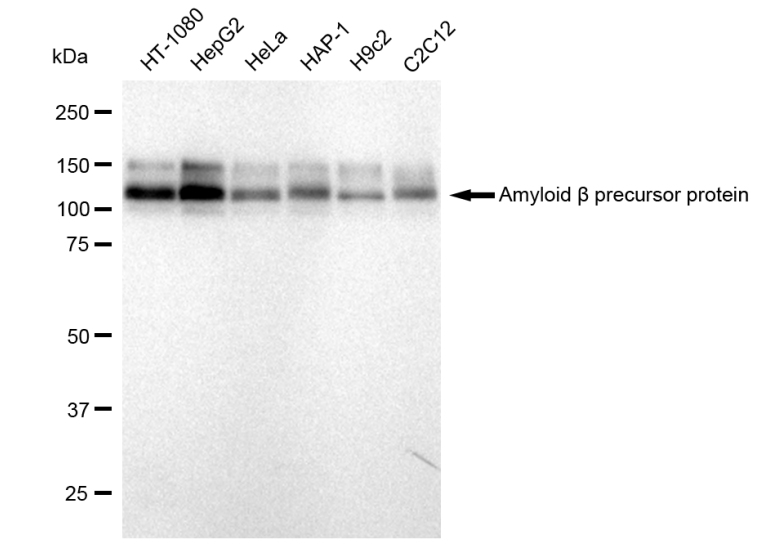 [KD Validated] Anti-APP Rabbit mAb [76L88M26]