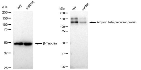 [KD Validated] Anti-APP Rabbit mAb [76L88M26]