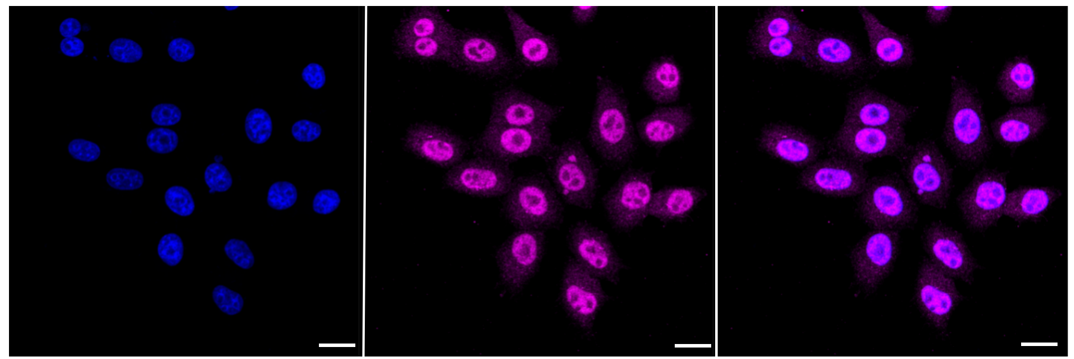 [KD Validated] Anti-CRK Rabbit mAb [63S33Q59]