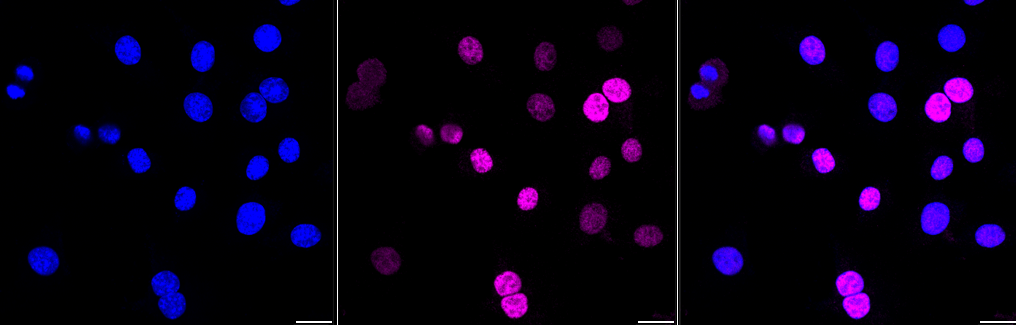 [KD Validated] Anti-CCND1 Rabbit mAb [49S10E73]