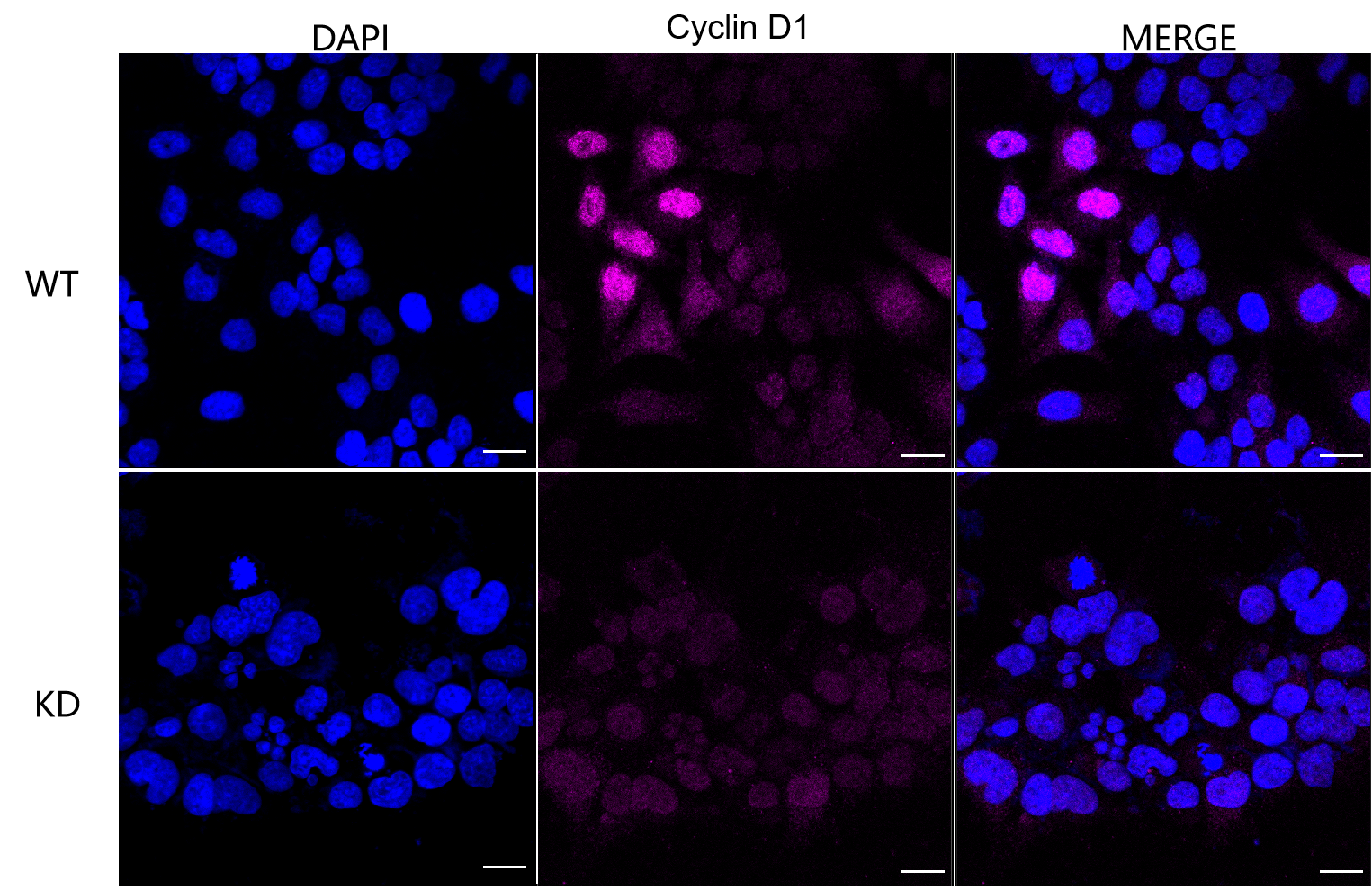 [KD Validated] Anti-CCND1 Rabbit mAb [49S10E73]