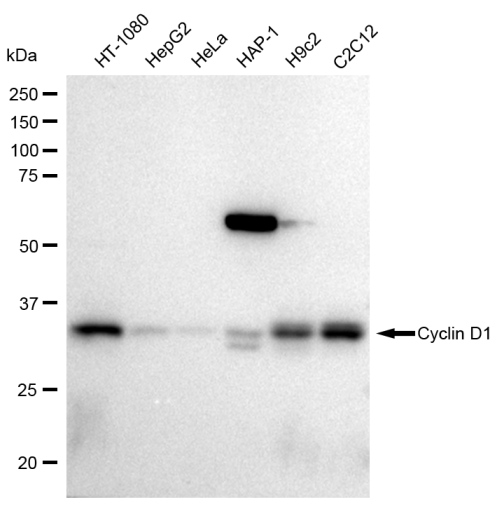 [KD Validated] Anti-CCND1 Rabbit mAb [49S10E73]