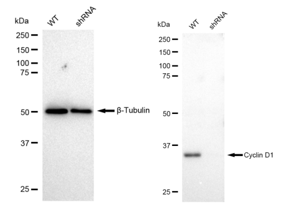 [KD Validated] Anti-CCND1 Rabbit mAb [49S10E73]