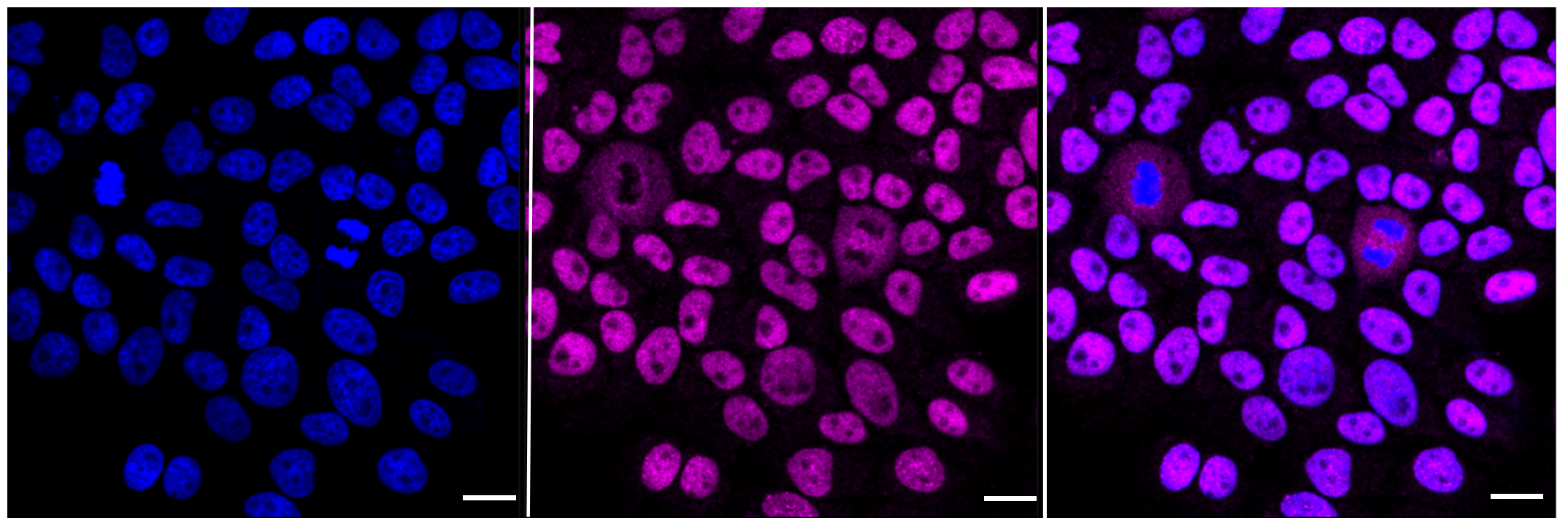 [KD Validated] Anti-CHAF1A Rabbit mAb [61M14J81]