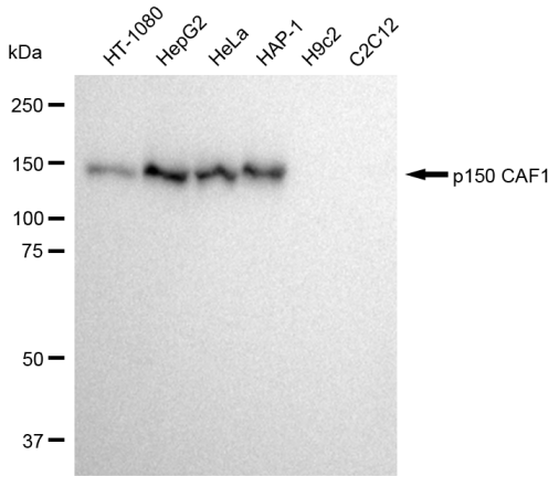 [KD Validated] Anti-CHAF1A Rabbit mAb [61M14J81]