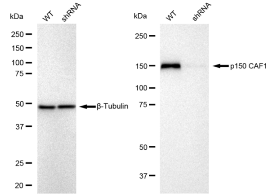 [KD Validated] Anti-CHAF1A Rabbit mAb [61M14J81]