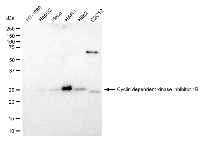 [KD Validated] Anti-CDKN1B Rabbit mAb [70B57G02]