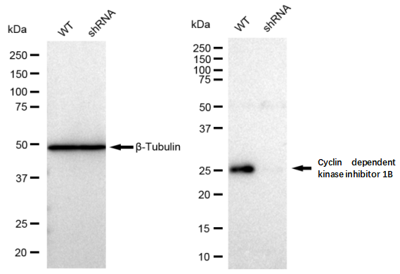 [KD Validated] Anti-CDKN1B Rabbit mAb [70B57G02]