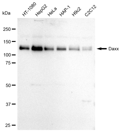 [KD Validated] Anti-DAXX Rabbit mAb [18L26S14]