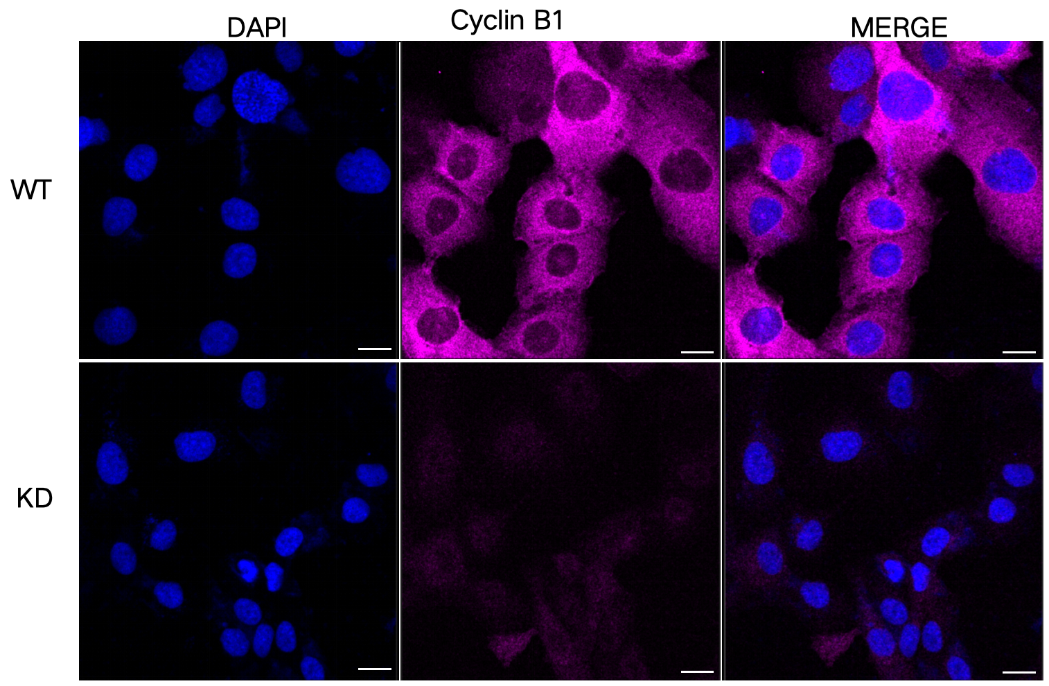 [KD Validated] Anti-CCNB1 Rabbit mAb [51O04N11]