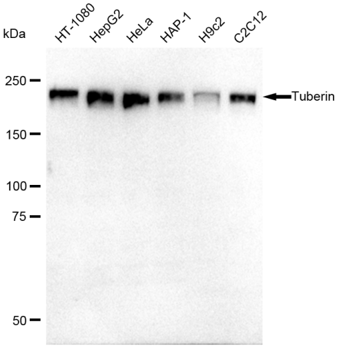 [KD Validated] Anti-TSC2 Rabbit mAb [76B70R61]