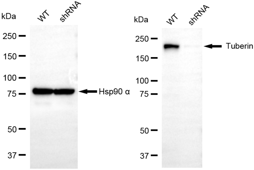 [KD Validated] Anti-TSC2 Rabbit mAb [76B70R61]