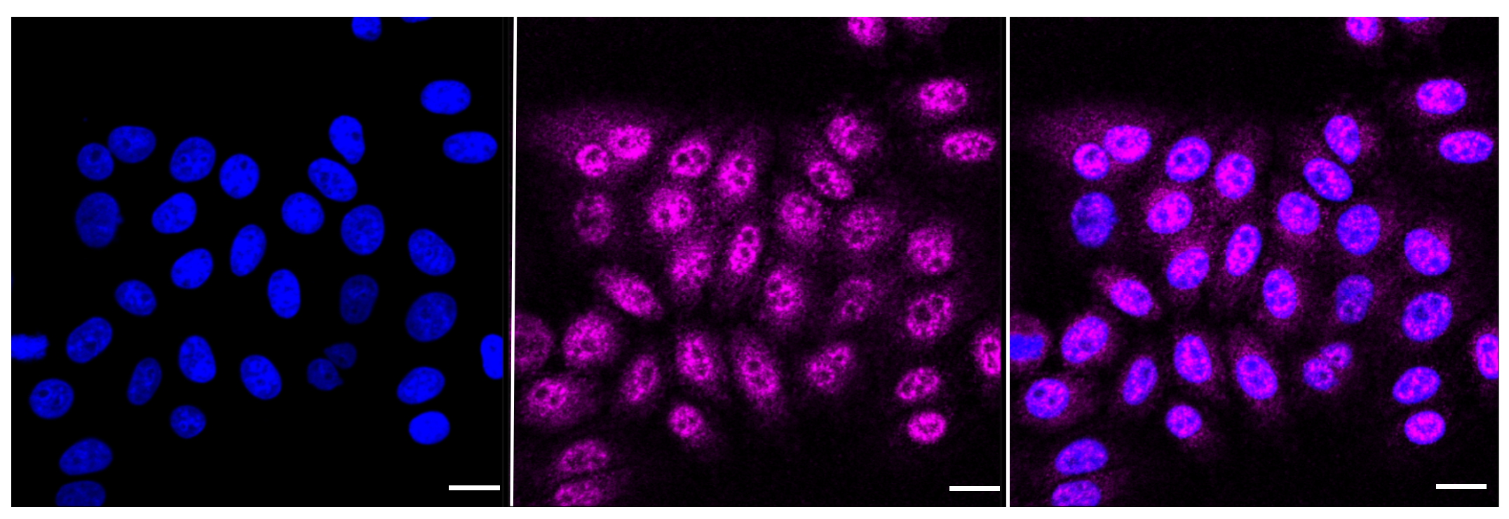 [KD Validated] Anti-CHUK Rabbit mAb [61B46B47]