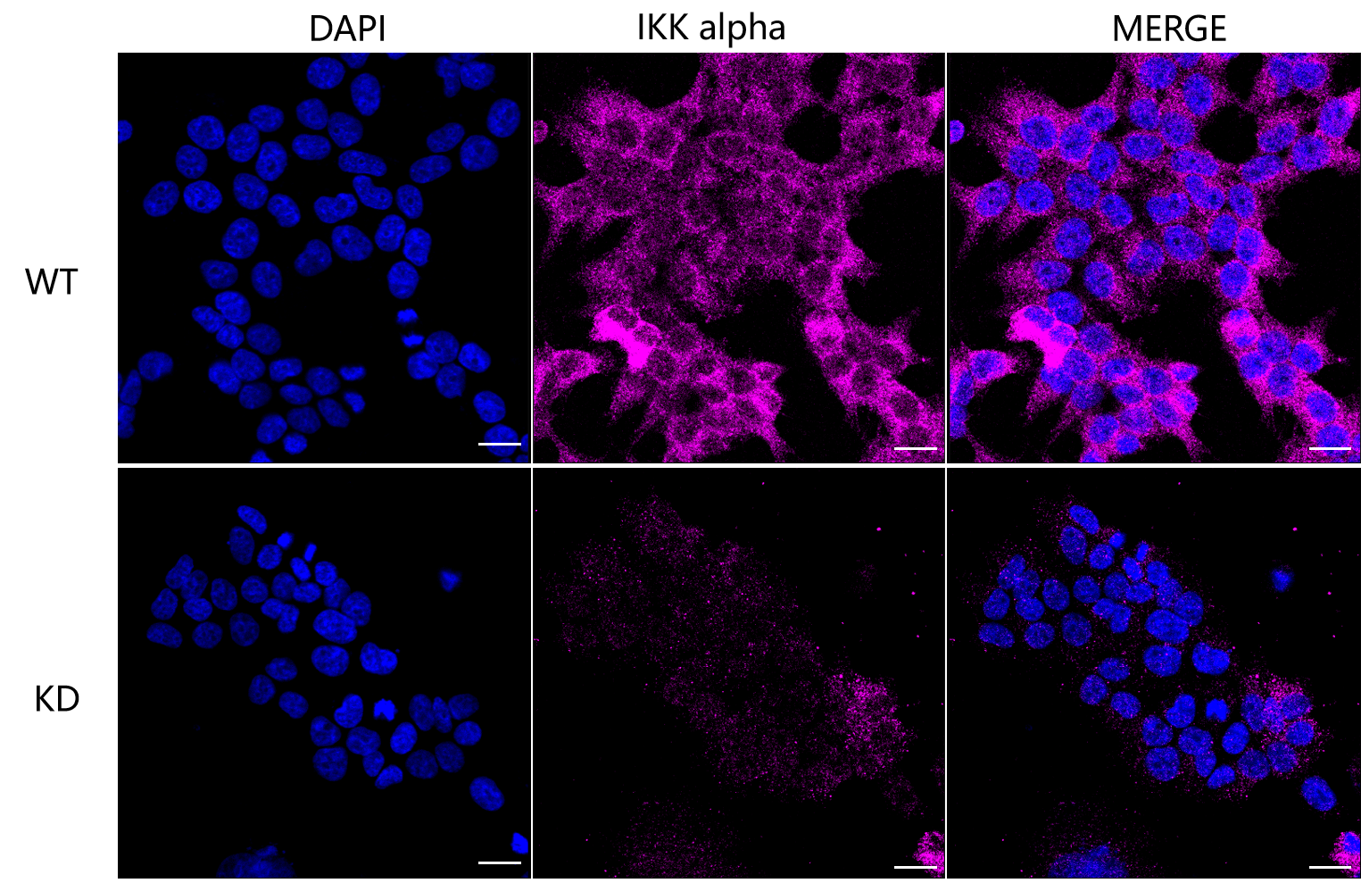 [KD Validated] Anti-CHUK Rabbit mAb [61B46B47]