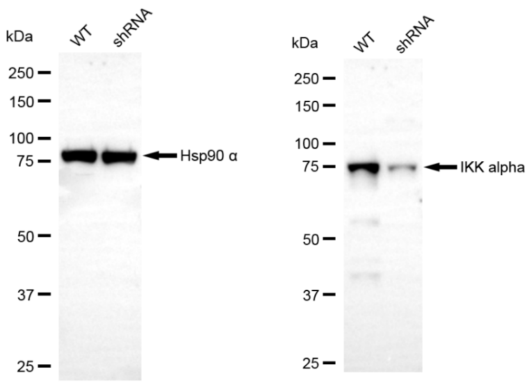 [KD Validated] Anti-CHUK Rabbit mAb [61B46B47]
