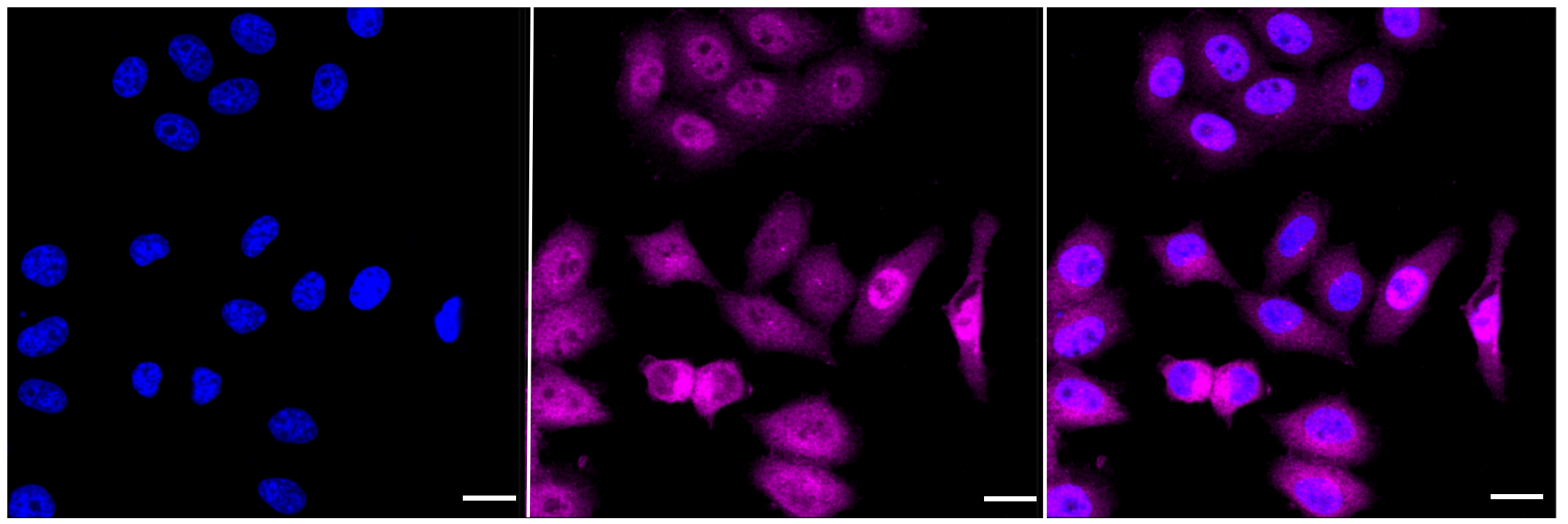 [KD Validated] Anti-ACLY Rabbit mAb [75C11C87]