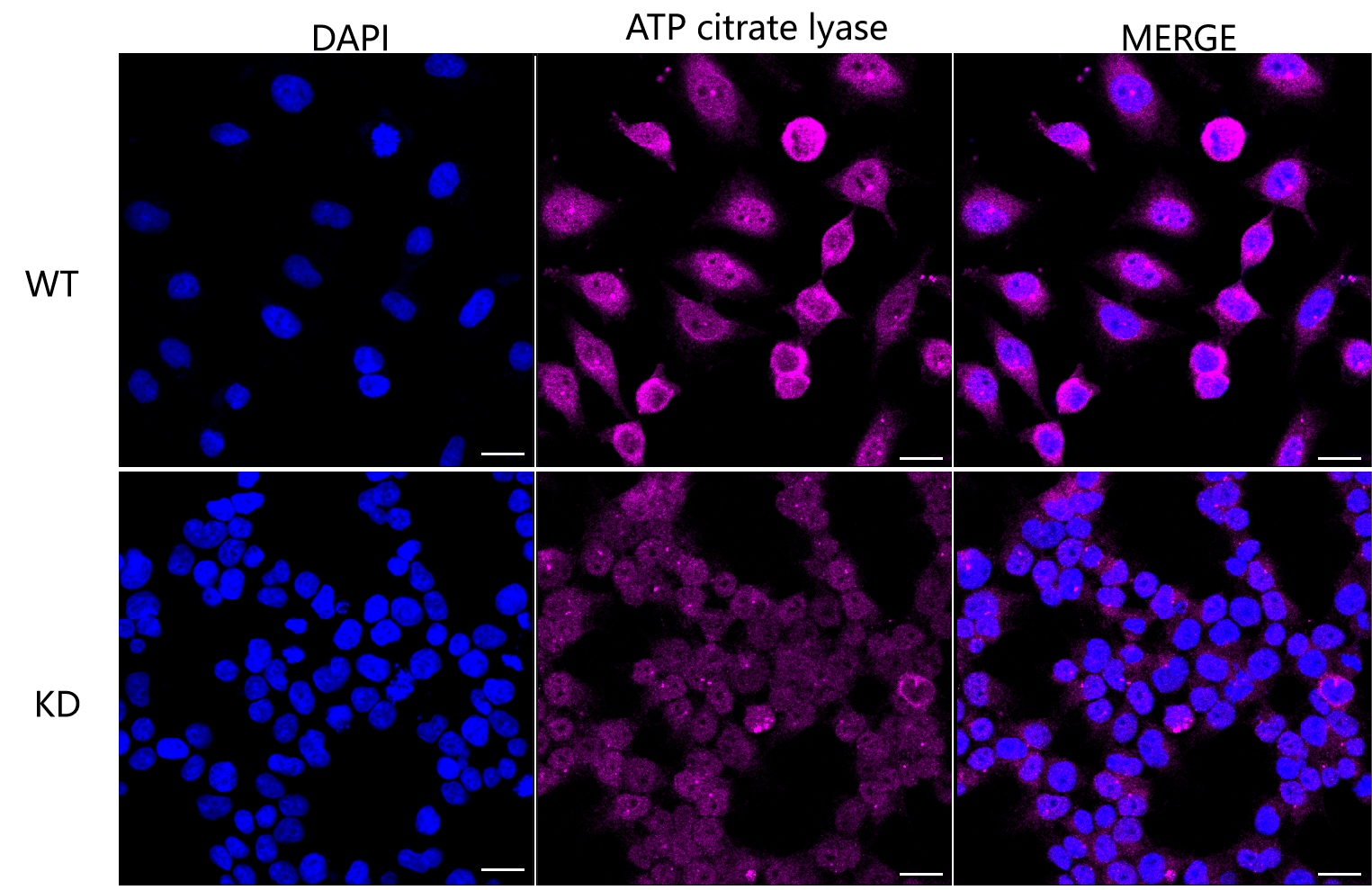 [KD Validated] Anti-ACLY Rabbit mAb [75C11C87]